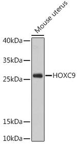 HOXC9 Polyclonal Antibody