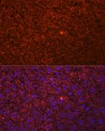 HSD17B13 Polyclonal Antibody