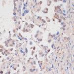 HTATSF1 Antibody in Immunohistochemistry (Paraffin) (IHC (P))