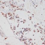 HTATSF1 Antibody in Immunohistochemistry (Paraffin) (IHC (P))