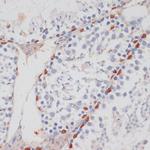 HTATSF1 Antibody in Immunohistochemistry (Paraffin) (IHC (P))