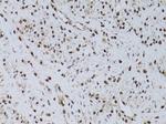 HUS1 Polyclonal Antibody