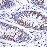 ICA1 Polyclonal Antibody