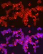 CD278 (ICOS) Antibody in Immunocytochemistry (ICC/IF)
