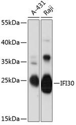 IFI30 Antibody in Western Blot (WB)