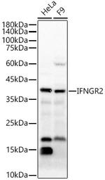 IFNGR2 Polyclonal Antibody