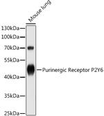 P2Y6 Polyclonal Antibody
