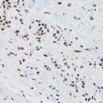 SUMO2 Antibody in Immunohistochemistry (Paraffin) (IHC (P))