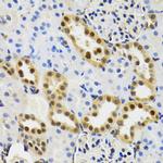 SUMO2 Antibody in Immunohistochemistry (Paraffin) (IHC (P))