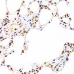 SUMO2 Antibody in Immunohistochemistry (Paraffin) (IHC (P))