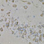 IL10RA Antibody in Immunohistochemistry (Paraffin) (IHC (P))