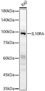 IL10RA Antibody in Western Blot (WB)