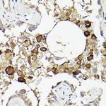 IL6R Polyclonal Antibody