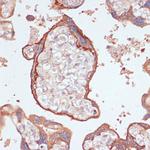 GP130 Antibody in Immunohistochemistry (Paraffin) (IHC (P))