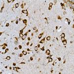 INSIG2 Polyclonal Antibody