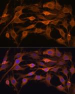 JAK1 Antibody in Immunocytochemistry (ICC/IF)