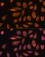 JAK1 Antibody in Immunocytochemistry (ICC/IF)