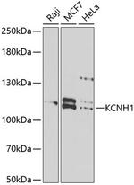 KCNH1 Polyclonal Antibody