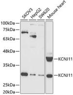 Kir6.2 (KCNJ11) Polyclonal Antibody