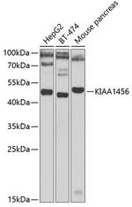 KIAA1456 Polyclonal Antibody