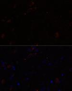 KIF17 Antibody in Immunohistochemistry (Paraffin) (IHC (P))