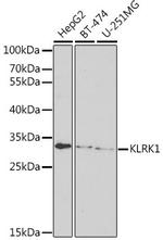 NKG2D Polyclonal Antibody