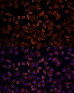 K-Ras Polyclonal Antibody