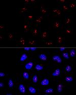 KRR1 Antibody in Immunocytochemistry (ICC/IF)
