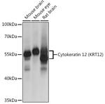 KRT12 Polyclonal Antibody