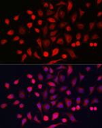 KRT16 Polyclonal Antibody