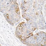 KRT16 Antibody in Immunohistochemistry (Paraffin) (IHC (P))