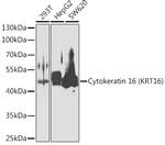 KRT16 Antibody in Western Blot (WB)