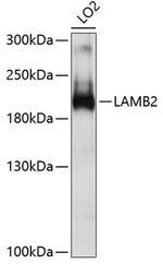 LAMB2 Polyclonal Antibody