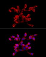 LARP4 Polyclonal Antibody
