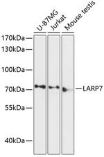 LARP7 Polyclonal Antibody