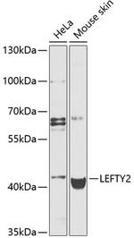 LEFTY2 Polyclonal Antibody