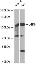 LGR6 Polyclonal Antibody