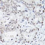 LIG4 Polyclonal Antibody