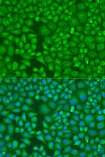 LLGL2 Polyclonal Antibody