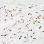 LSP1 Polyclonal Antibody