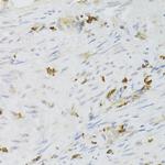 LSP1 Antibody in Immunohistochemistry (Paraffin) (IHC (P))