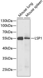 LSP1 Antibody in Western Blot (WB)