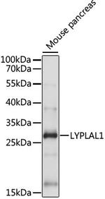 LYPLAL1 Polyclonal Antibody