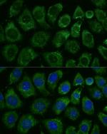 MEKK1 Antibody in Immunocytochemistry (ICC/IF)