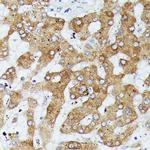 MEKK1 Antibody in Immunohistochemistry (Paraffin) (IHC (P))