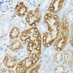 MEKK1 Antibody in Immunohistochemistry (Paraffin) (IHC (P))