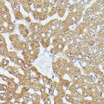 MEKK1 Antibody in Immunohistochemistry (Paraffin) (IHC (P))