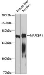 MAPKBP1 Polyclonal Antibody