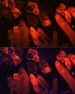Myoglobin Antibody in Immunocytochemistry (ICC/IF)