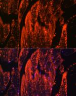 Myoglobin Polyclonal Antibody